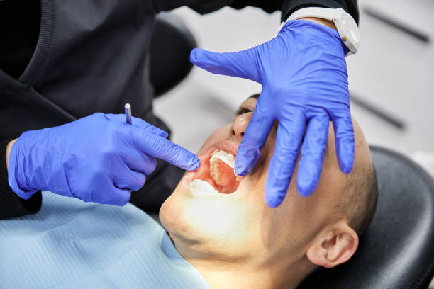 Best Cracked Tooth Emergency Dentist  in Osprey, FL